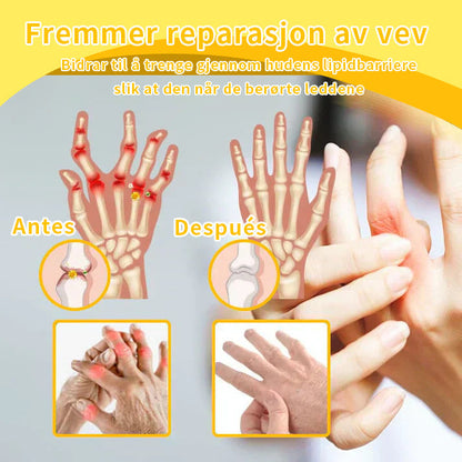 ODALIT™ Toxina Botulínica & Veneno de Abeja Alivio del Dolor Crema Cicatrizante de Huesos🔄