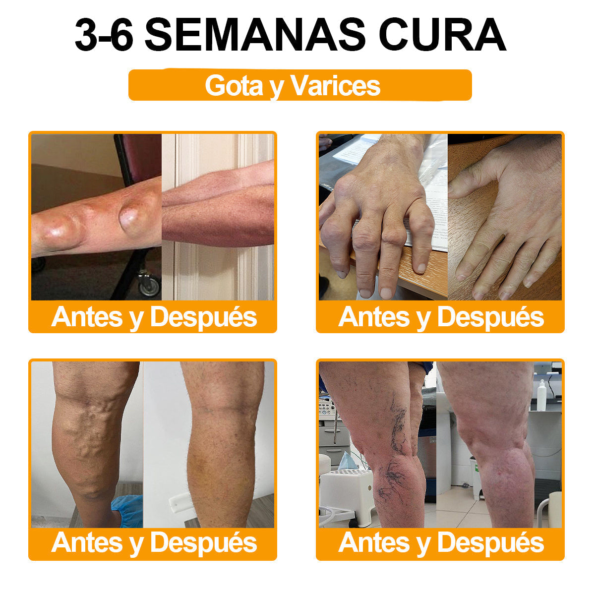 ODALIT™ Toxina Botulínica & Veneno de Abeja Alivio del Dolor Crema Cicatrizante de Huesos🔄