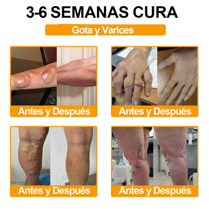 ODALIT™ Toxina Botulínica & Veneno de Abeja Alivio del Dolor Crema Cicatrizante de Huesos🔄