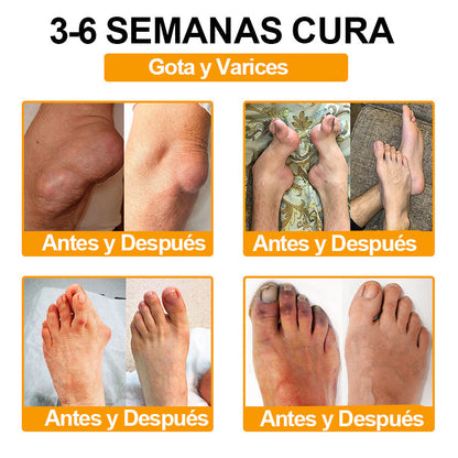 ODALIT™ Toxina Botulínica & Veneno de Abeja Alivio del Dolor Crema Cicatrizante de Huesos🔄