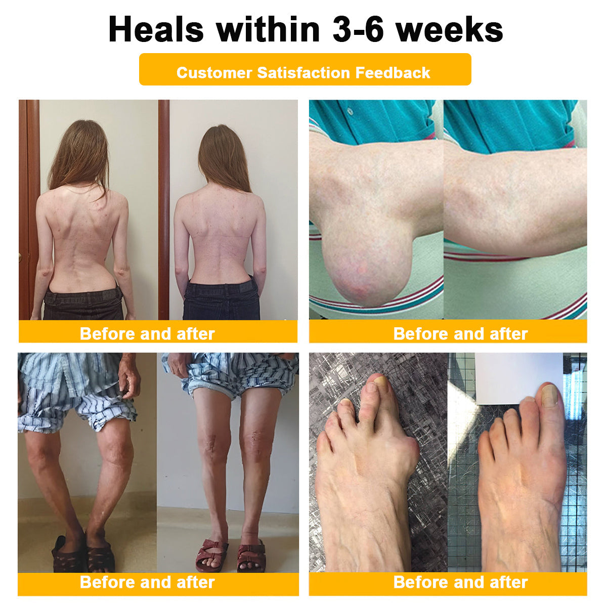 ODALIT™ Toxina Botulínica & Veneno de Abeja Alivio del Dolor Crema Cicatrizante de Huesos🔄