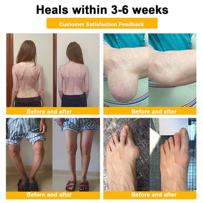 ODALIT™ Toxina Botulínica & Veneno de Abeja Alivio del Dolor Crema Cicatrizante de Huesos🔄