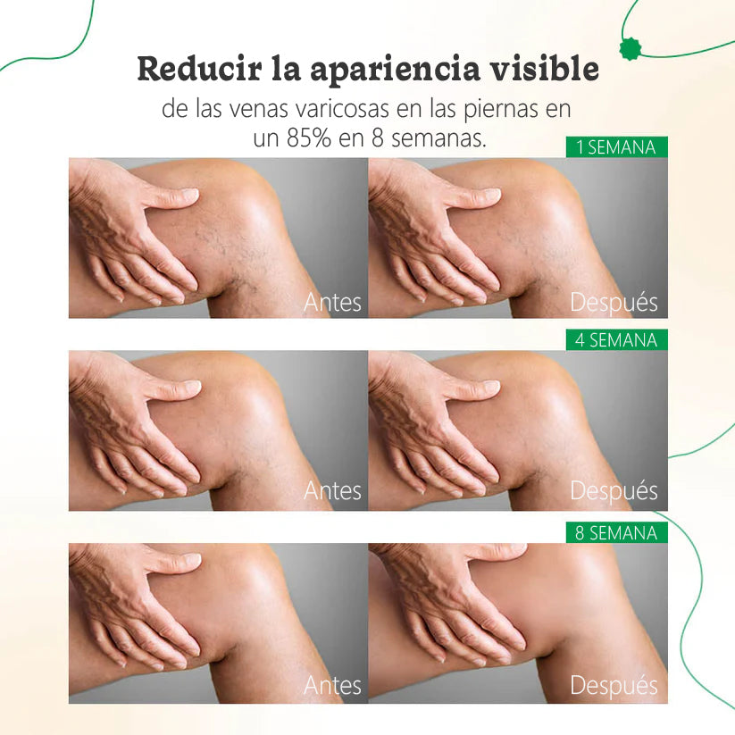 ODALIT™ Crema de Terapia para Venas
