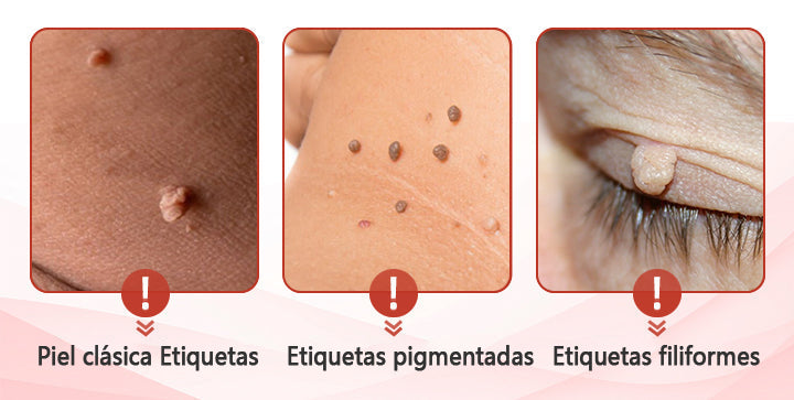 💥ODALIT™microparche avanzado sin dolor💥