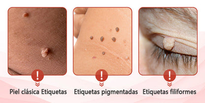 💥ODALIT™microparche avanzado sin dolor💥