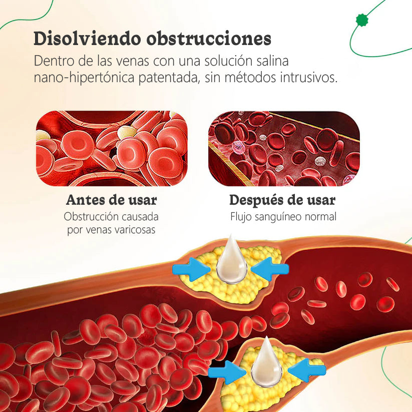ODALIT™ Crema de Terapia para Venas