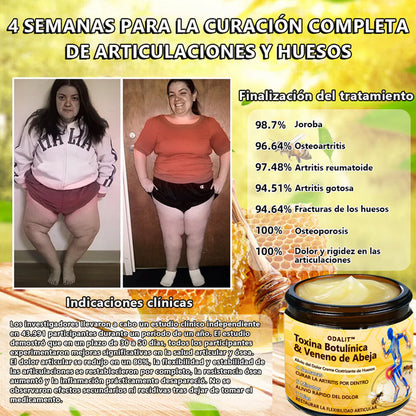 ODALIT™ Toxina Botulínica & Veneno de Abeja Alivio del Dolor Crema Cicatrizante de Huesos🔄