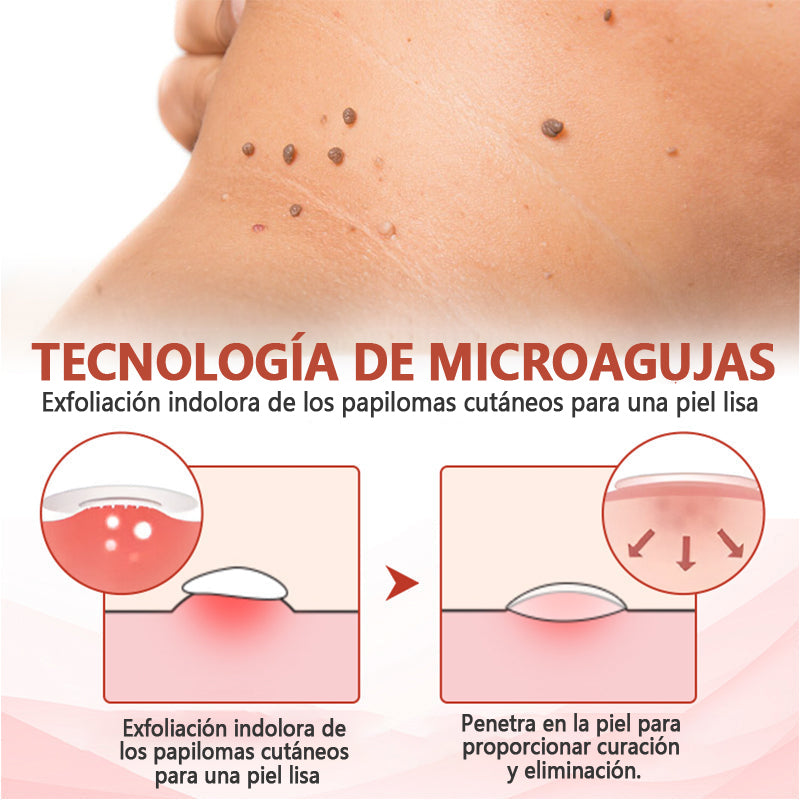 💥ODALIT™microparche avanzado sin dolor💥