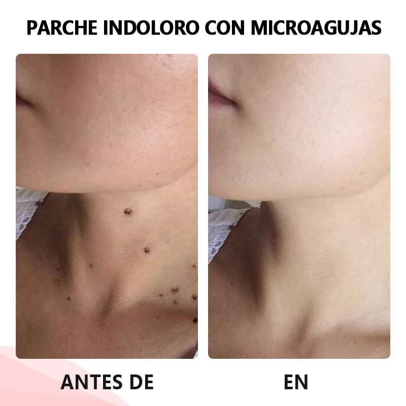 💥ODALIT™microparche avanzado sin dolor💥